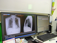 左が医用画像システム、右が電子カルテとレセコンの画面。モニタの右に小さなPC-over-IPクライアントが置かれている